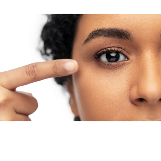How To Remove Dark Circles Naturally