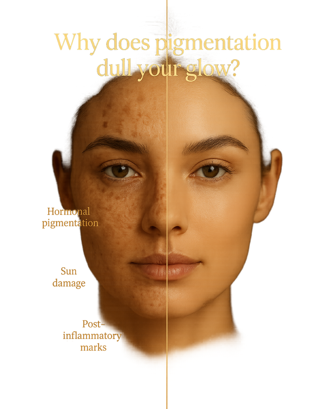 Anti-Pigmentation Cream - Unleash Your Natural Glow!