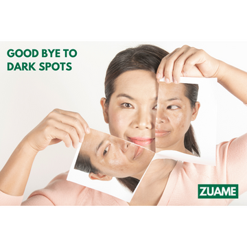 How To Remove Dark Spots From Skin