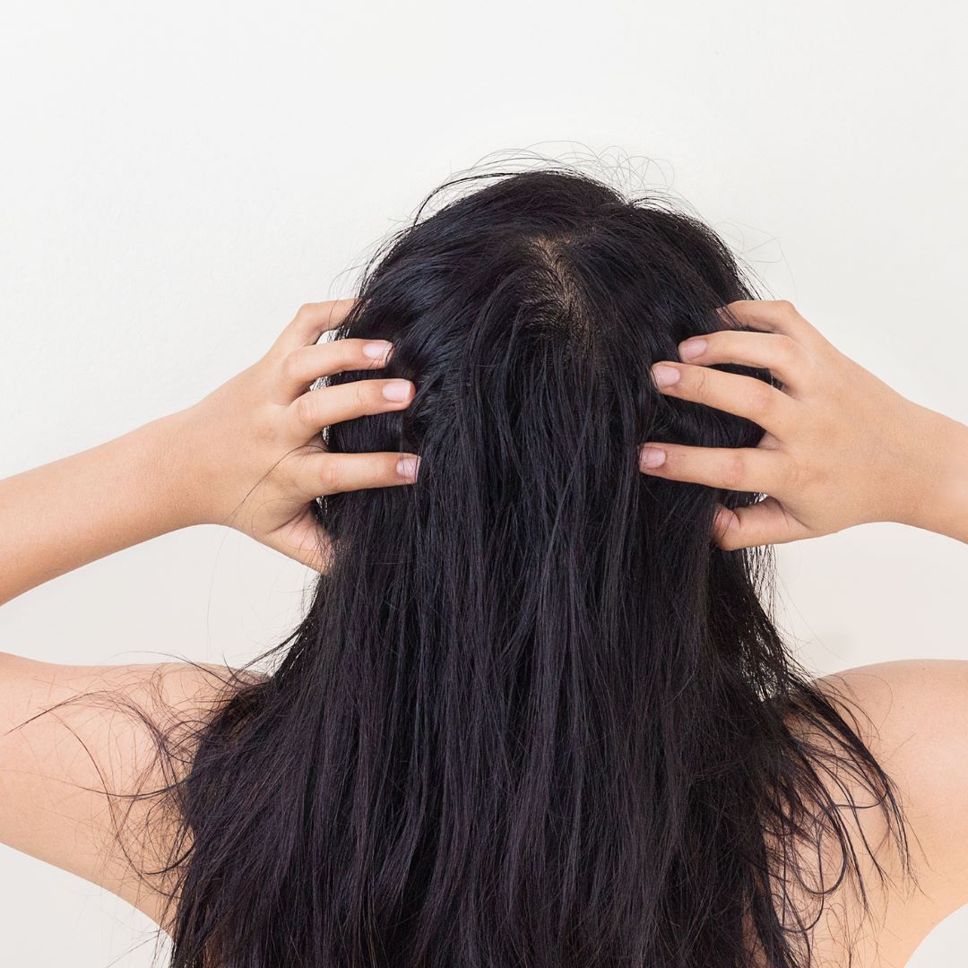 How To Stop Hair & Scalp Itching Naturally